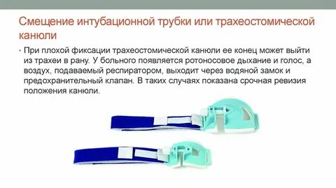 Уход за интубационной трубкой