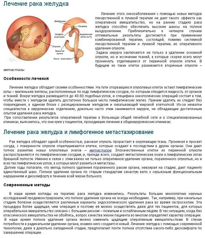 Диета при онкологии ЖКТ. Диета при онкологии желудка. Диета при больном желудке. Диета при удаленном желудке. Операция удаления опухоли желудка