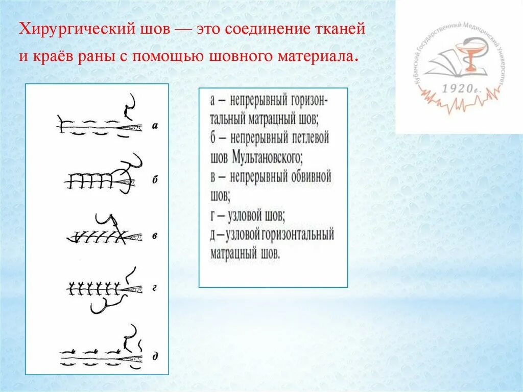 Виды хирургического шва. Названия хирургических швов. Как называется шов после операции