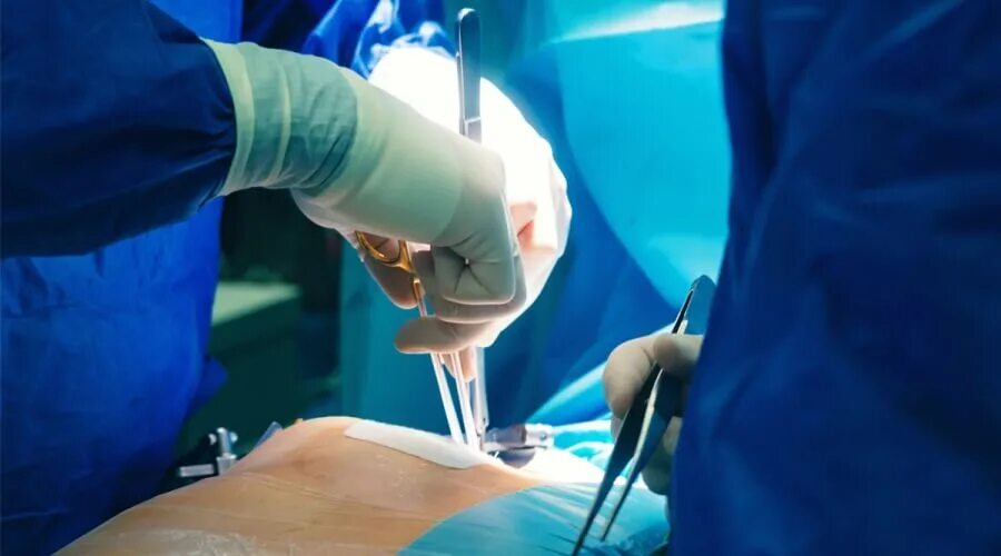 Операция опыт. Операция багратион цель. Ортогнатическая операция в операционной. Загоризонтная высадка морского десанта схема. Алиев пластический хирург.