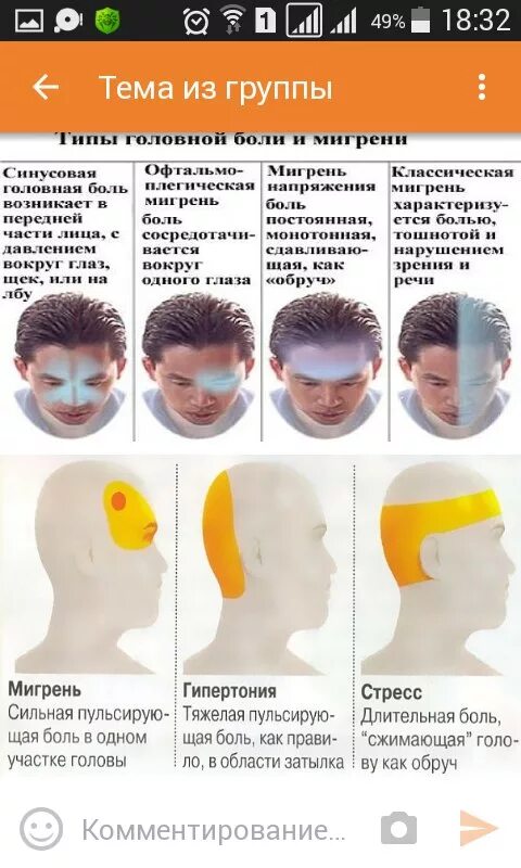Схема локализации головной боли. Причины головной боли. Болит затылок головы. Головная в затылке