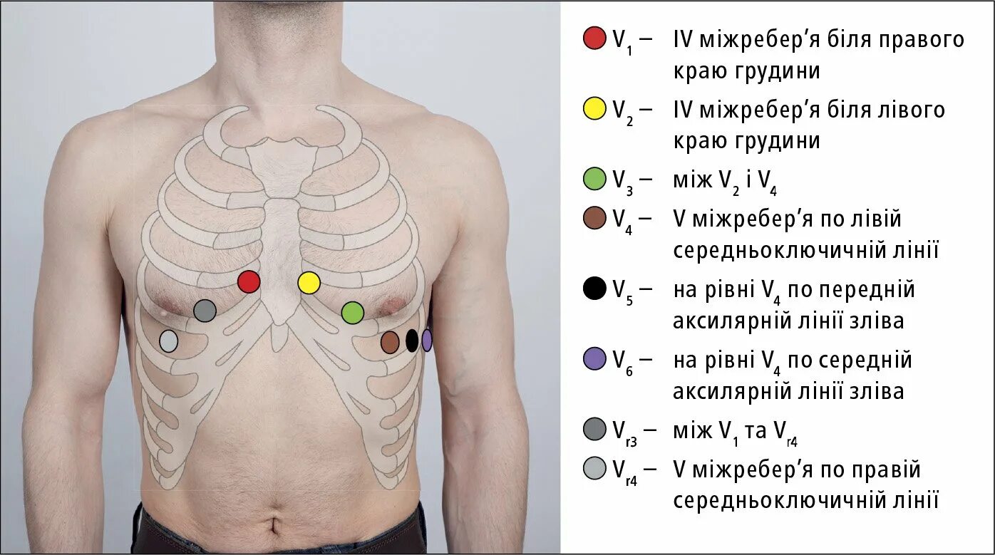 Экг последовательность наложения электродов. Датчики экг наложение электродов. Как правильно ставить экг. Схема постановки электродов экг. Алгоритм снятия экг грудные отведения.