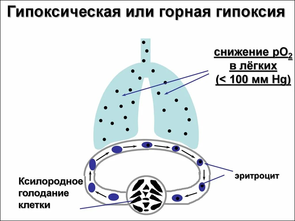 Гипоксическая гипоксия. Гипобарическая гипоксическая гипоксия. Экзогенная гипоксия. Экзогенная гипоксия проявления. Голод клеток