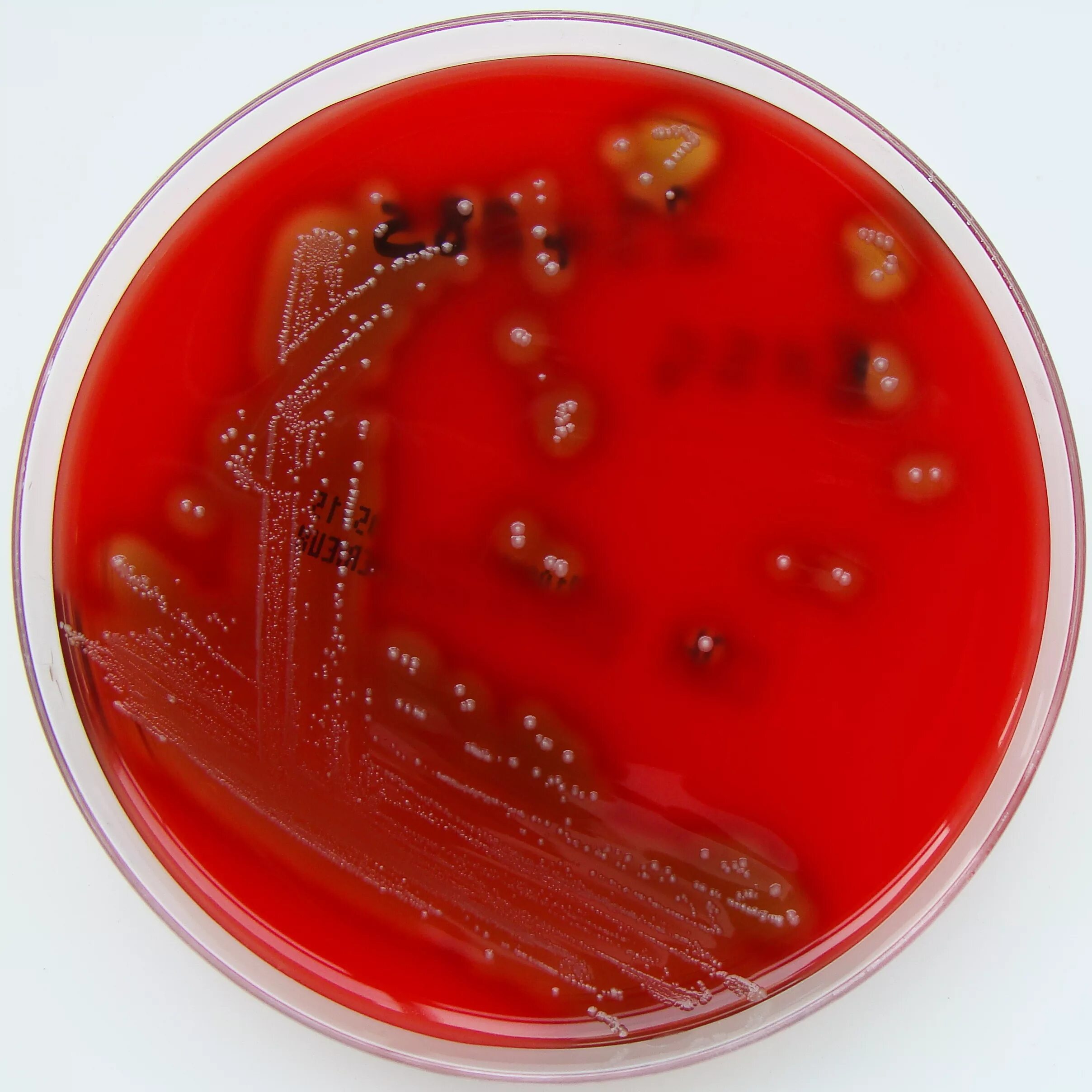 Streptococcus