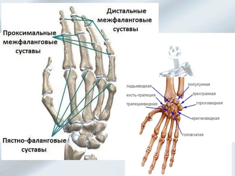 Первый запястно пястный сустав. Движения в запястно пястном суставе. пястно фаланговые суставы повреждение. пятснофаланговый сустав. проксимальные межфаланговые суставы кисти.