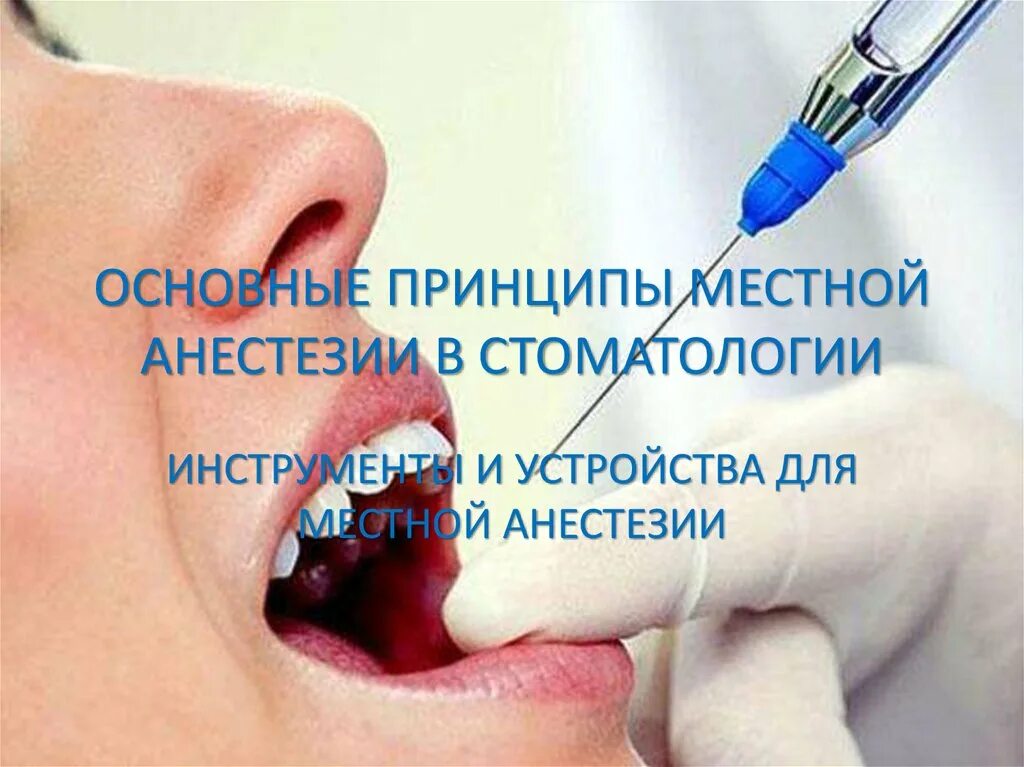 Анестезия в стоматологии. Местное обезболивание в стоматологии. Местная анестезия в стоматологии презентация. Местное обезболивание в стоматологии презентация. Домашняя анестезия