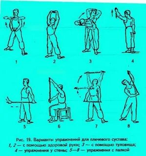 Лфк при вывихах