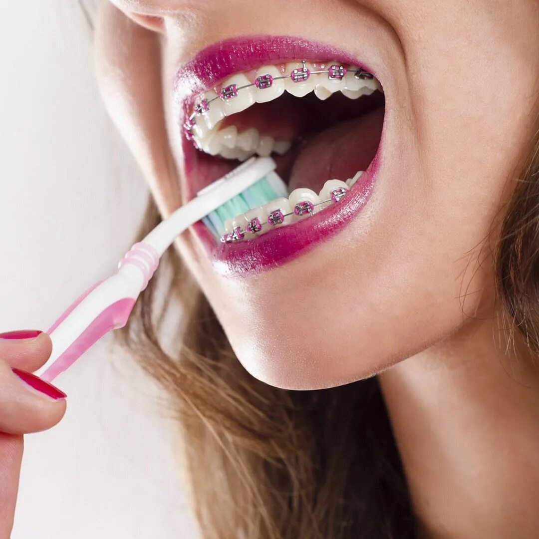 Гигиенический уход полости рта. Чистим зубы!. Гигиена полости рта. Гигиена ротовой полости. Техника чистки зубов.