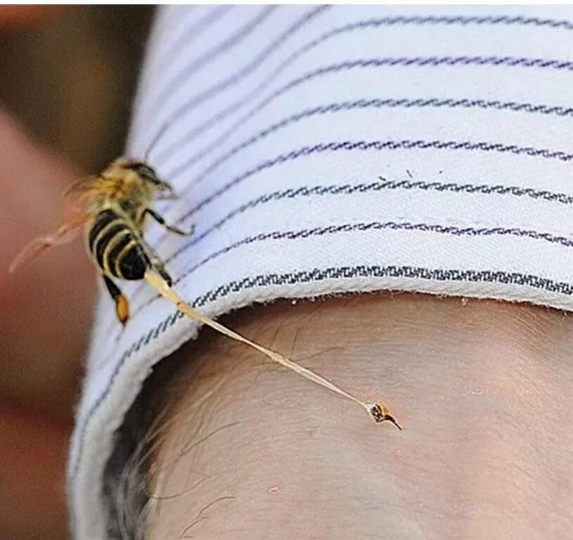 Шершень обыкновенный vespa crabro. Укус шершня жало. Шмель пчела оса шершень укусы. Шершень обыкновенный vespa crabro. Шмель пчела оса шершень.