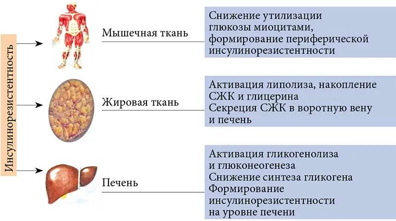 Инсулинорезистентность клинические проявления. Кожные симптомы инсулинорезистентности. Снижению выраженности инсулинорезистентности. Инсулинорезистентность мышечной ткани.