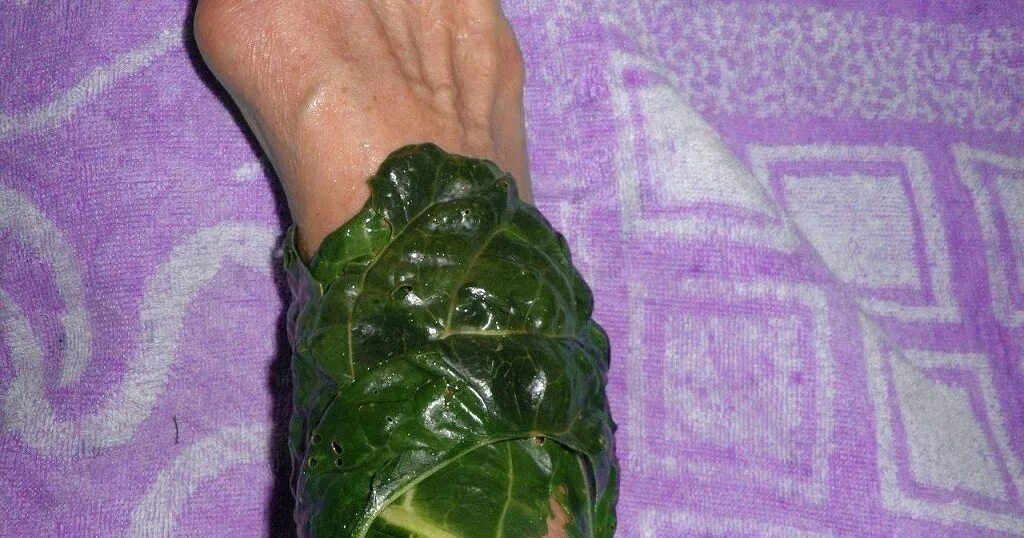 Капустный лист при артрозах. Капустный лист на ступне. капустный лист от отеков. капустный лист прикладывают. капустные листья при.