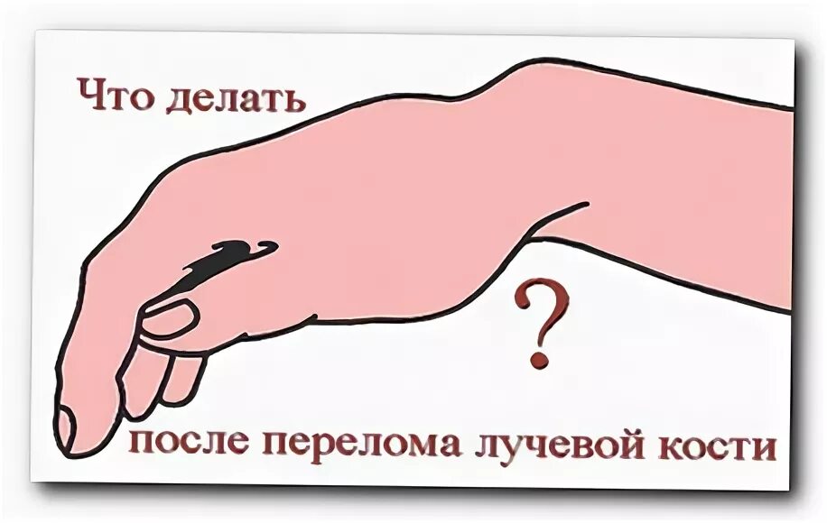 Как разрабатывать кисть руки после снятия гипса
