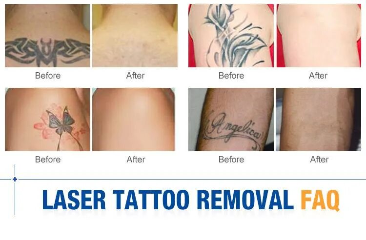 Через сколько после тату можно в баню. Цветные тату после заживления. Через сколько после тату можно в баню. Через сколько после тату можно в баню. Через сколько после тату можно в баню.