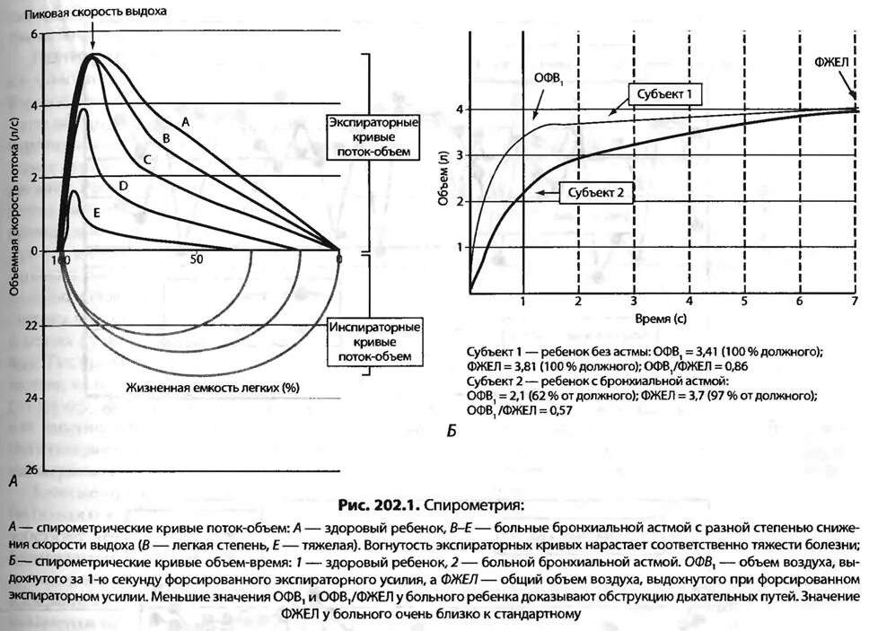 Спирометрия с бронхолитиком подготовка. Спирометрия при бронхиальной астме показатели. График спирометрии при бронхиальной астме. Заключение ФВД при бронхиальной астме. Спирография при бронхиальной астме показатели.