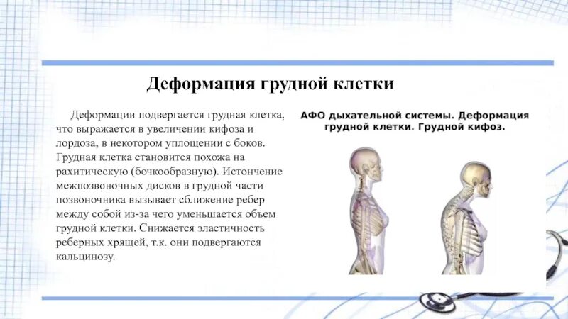 Что значит деформированный