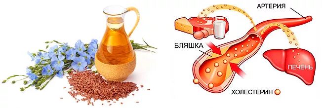 Масла для понижения холестерина в крови. Масла снижающие холестерин. Льняное масло снижает холестерин.