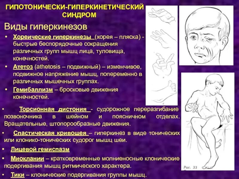 Болезнь непроизвольные движения