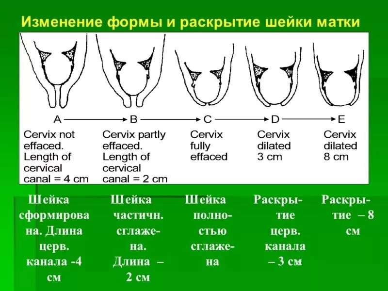 Как должна выглядеть здоровая матка Радиоволновая хирургия в Севастополе: удаление образований радиоволнами клиника