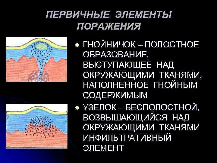 Первичные и вторичные поражения