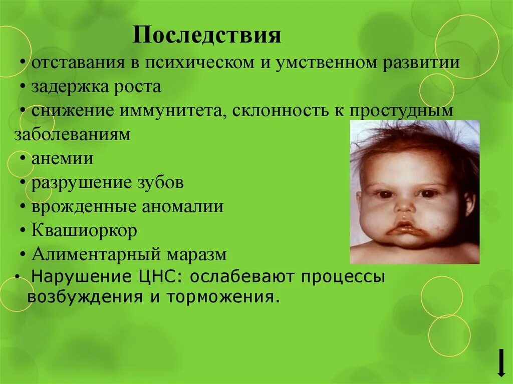 Характер нарушения физического и умственного развития ребенка. Отставание в умственном развитии. нарушения развития.