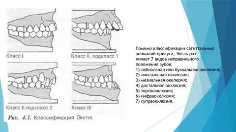 Классы аномалий