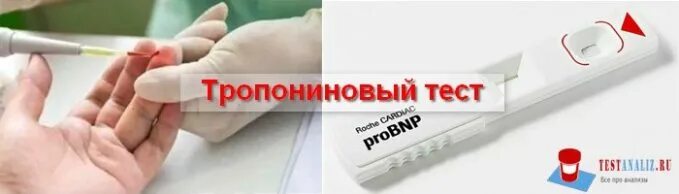 Экспресс тест на инфаркт. Тропониновый экспресс тест. Оценка тропонинового теста. Тропониновый тест при инфаркте. Тропонин/тропониновый тест.