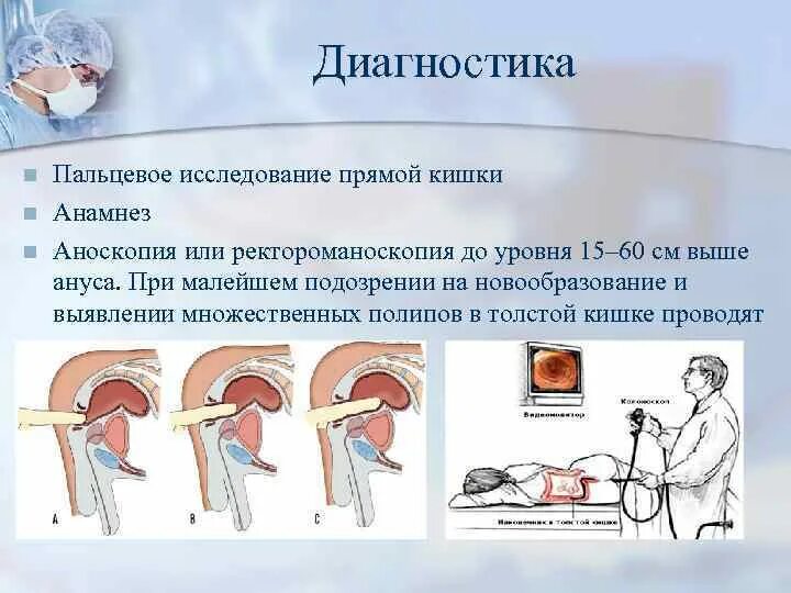 Ректальные железы. Пальцевое исследование прямой кишки. Ректальное исследование прямой кишки. Пальцевый осмотр прямой кишки. Пальцевое ректальное исследование прямой.