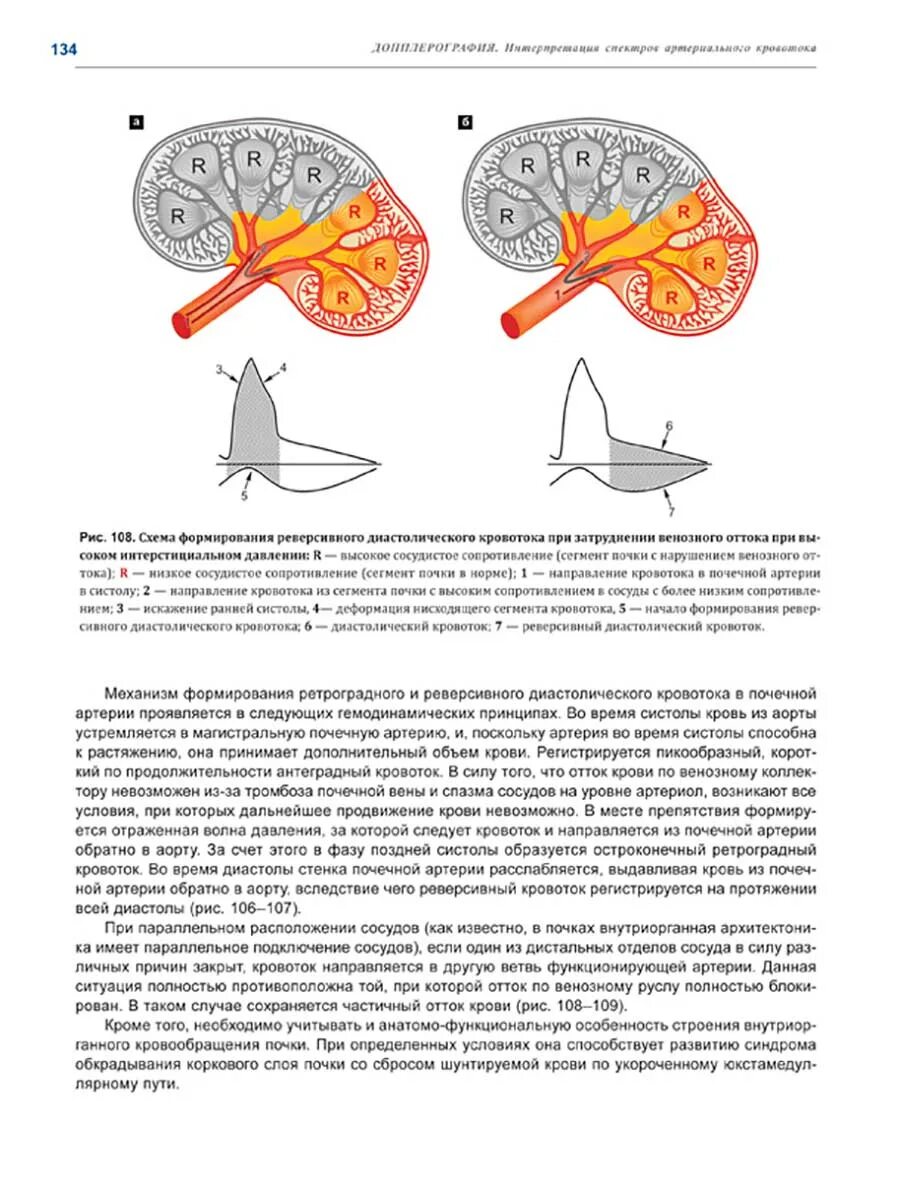 Венозный проток допплерометрия. Реверсный кровоток у плода. Показатели кровотока в венозном протоке. Допплерометрия венозного протока норма. Нулевой диастолический кровоток в пуповине.