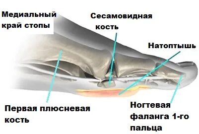 Сесамовидные кости стопы