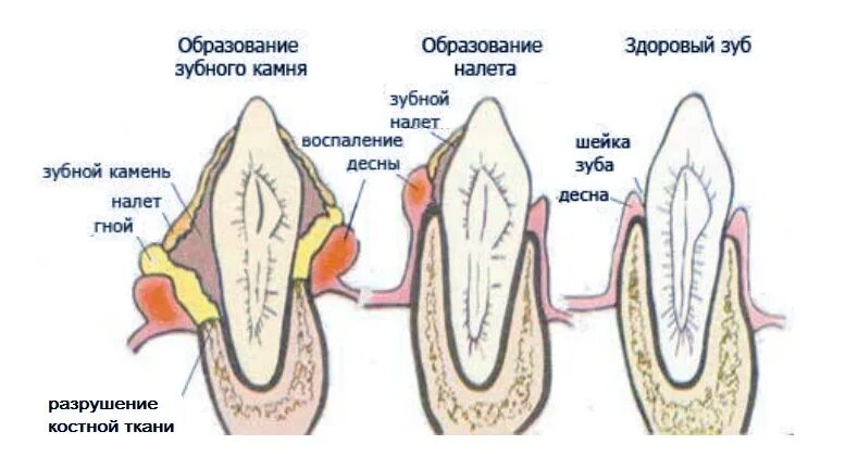 Матрица гаряева зубы и десна