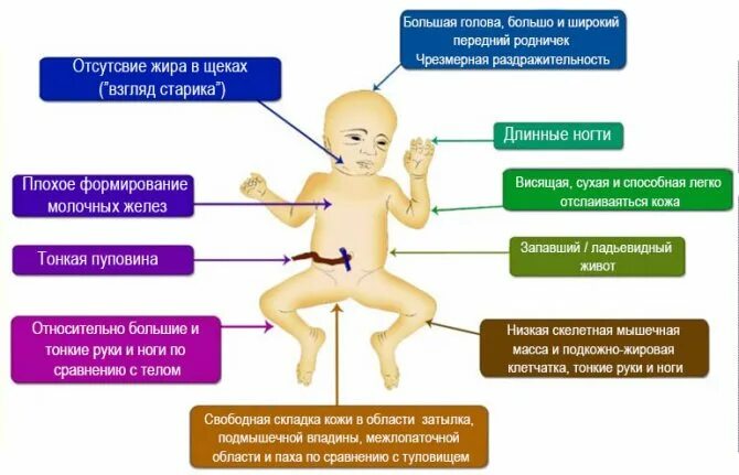 Синдром 3 триместра. Синдром задержки развития плода диагностика. Синдром задержки внутриутробного развития. Синдром селективной задержки развития плода. Внутриутробная задержка роста плода.