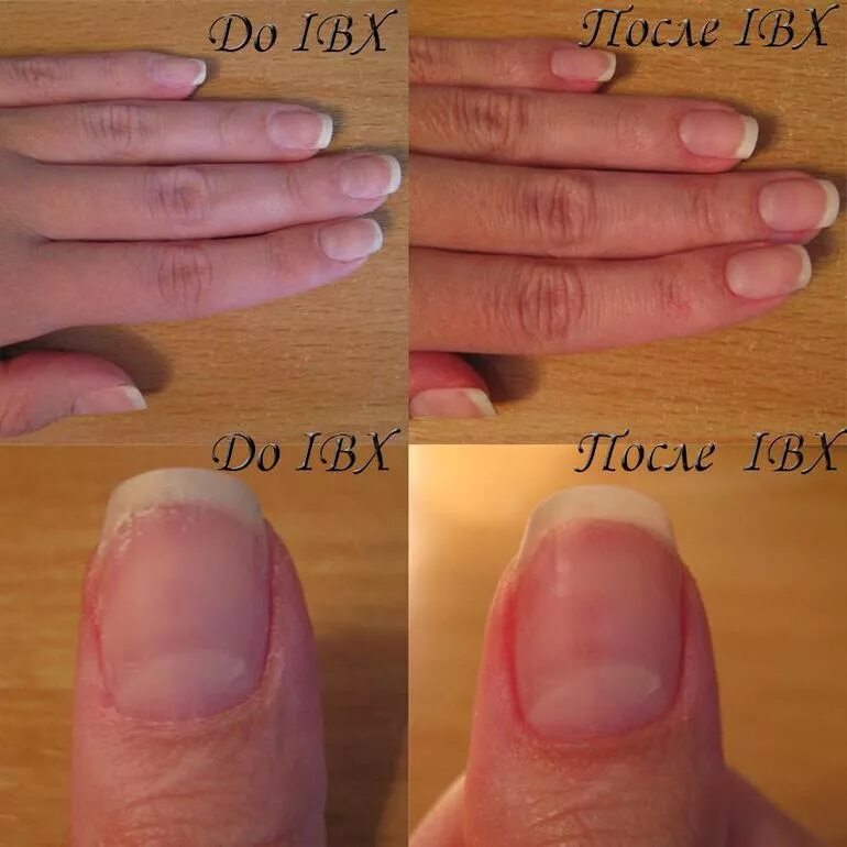 Почему ногти растут медленно. Маникюр до и после. Ногти отросшие за месяц.