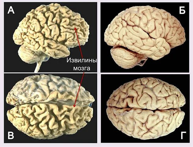 Сколько извилин в мозгах