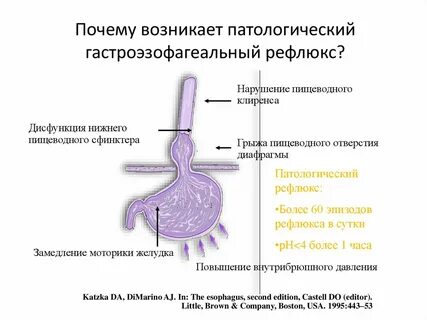Билиарный рефлюкс эзофагит