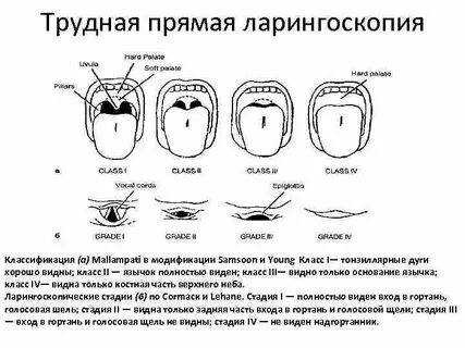 Видна щель