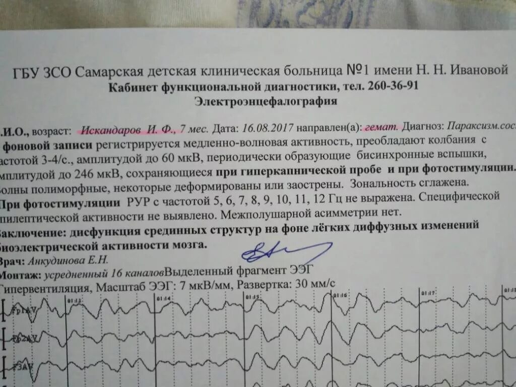 Ээг отзывы детям. ЭЭГ нормальные показатели у ребенка. ЭЭГ головного мозга здорового ребенка. ЭЭГ расшифровка ЭЭГ. Заключение ЭЭГ здорового человека расшифровка.