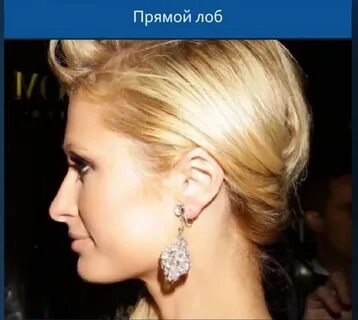 Прямой лоб