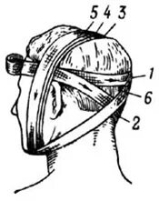 Крестообразная на затылок. Повязка уздечка техника наложения. Наложение повязки на голову уздечка. Уздечка бинтование. Перевязка уздечка головы.