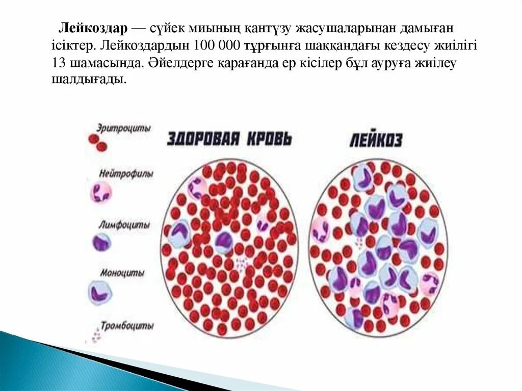 Онкологический больной. Хронические лейкозы диагностические критерии. Положительная реакция на миелопероксидазу. Лейкоз у пожилых людей. Лейкоз у пожилых людей.