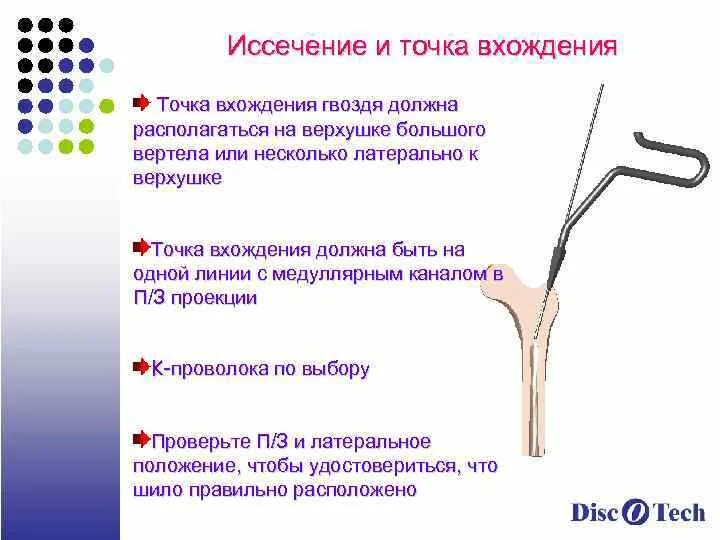 Располагающихся на верхушке