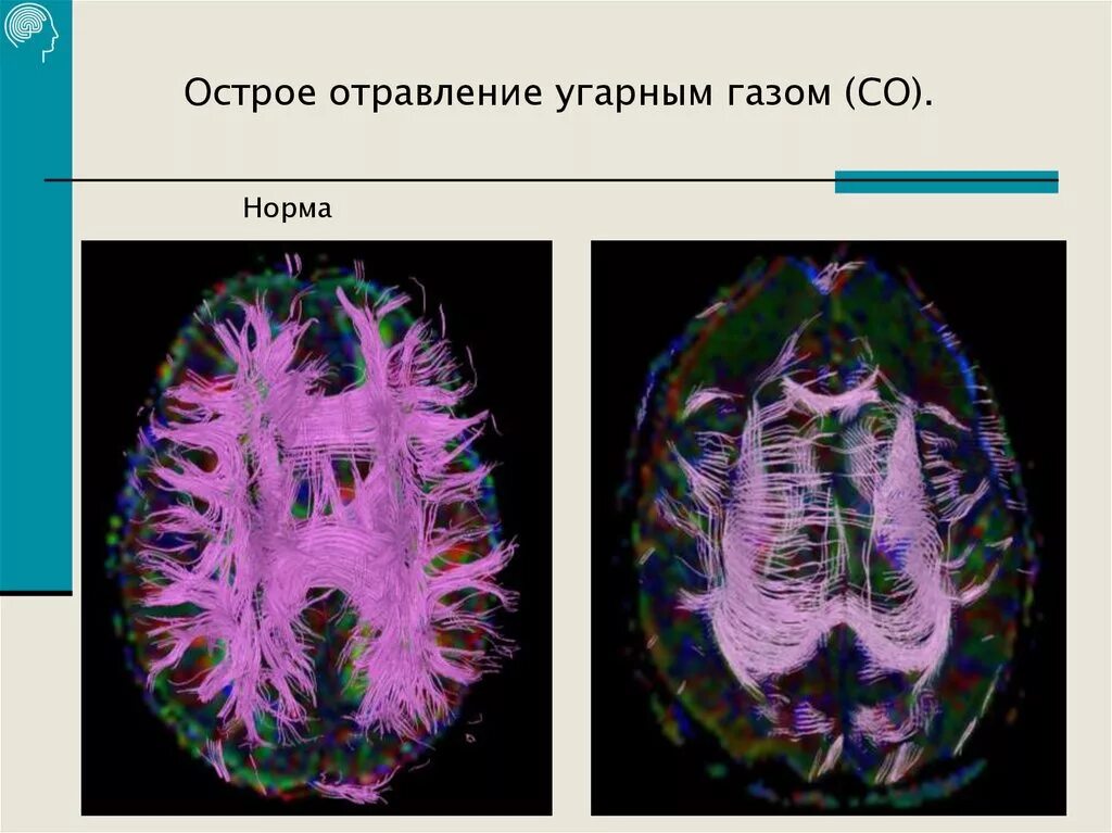 Институт головного мозга санкт. Институт мозга человека имени н. п. Бехтеревой РАН. Институт головного мозга Бехтеревой сайт. Мозг человека имени Бехтеревой. ПЭТ Нейровизуализация.