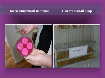 Посев кишечной палочки