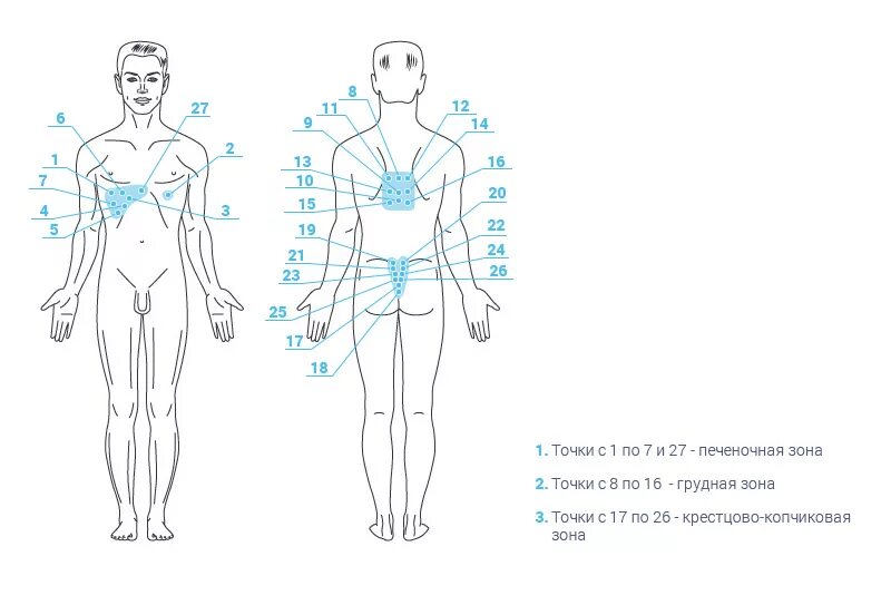 Схема постановки пиявок при сердечных заболеваниях. Как правильно поставить пиявку. Точки постановки пиявок на шее сзади. Схема постановки пиявок при бронхите и пневмонии. Схема точек постановки пиявок.