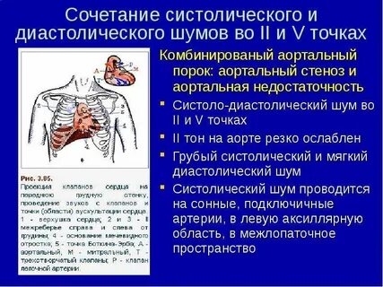 Сочетанный порок