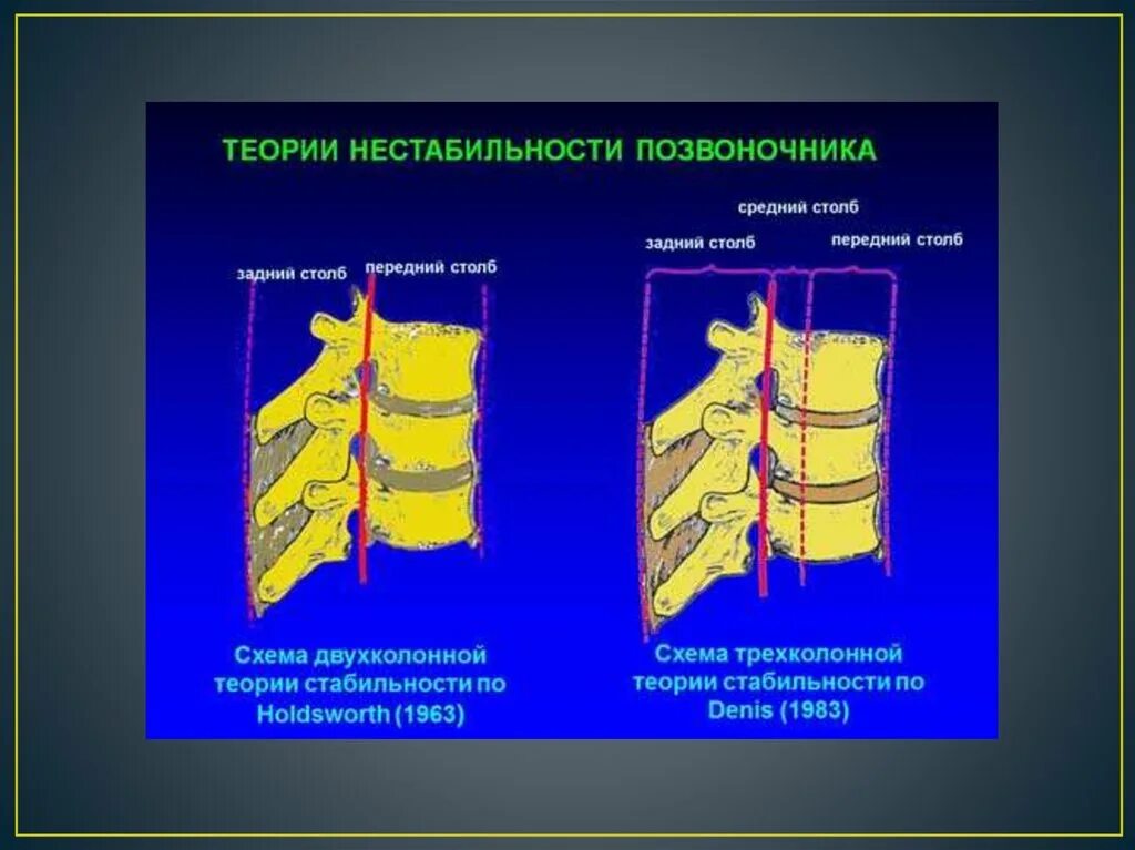 Опорные колонны позвоночника. Нестабильные повреждения позвоночника. Теория стабильности позвоночника. Передние и задние структуры позвоночника.