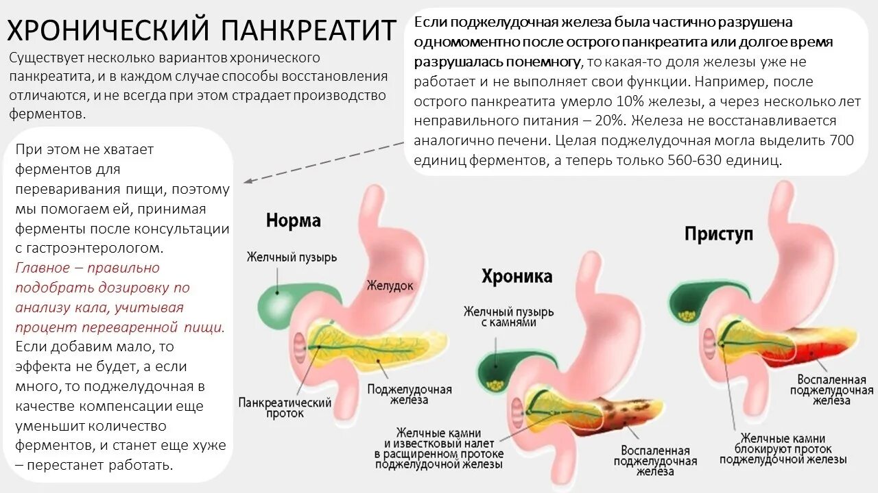 Сколько живут с хроническим панкреатитом. Фото людей с хроническим панкреатитом. Хронический панкреатит малину можно.