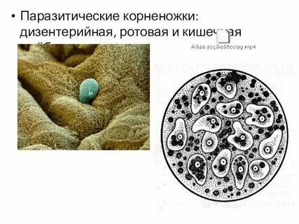 Амеба паразит или нет