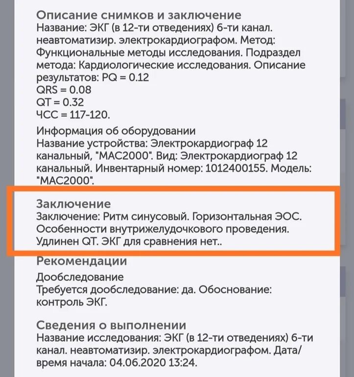 Заключение экг горизонтальное положение. Заключение по экг. экг заключение пример. заключение экг образец. экг заключение норма.