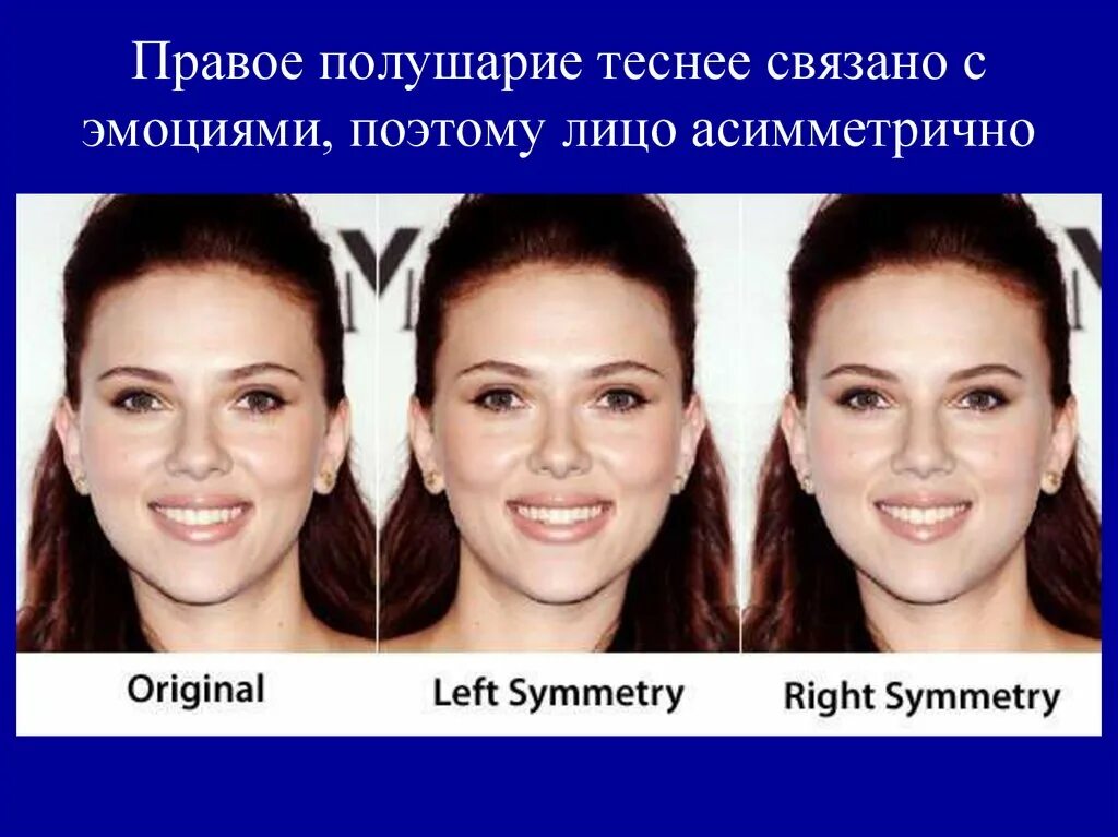 Почему левое больше правого. Исправление асимметрии лица. Асимметричность лица. Исправить асимметрию лица. Несимметричное лицо.