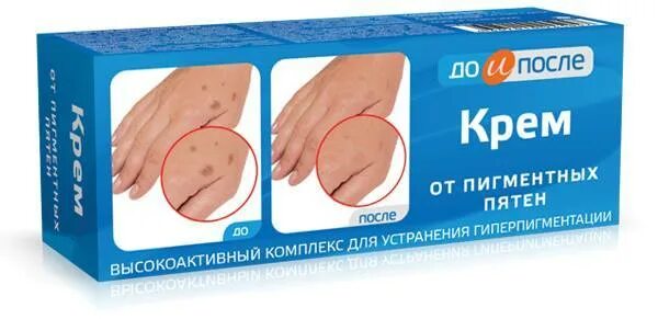 ахромин крем отбеливающий. крем от пятен на коже пигментных. дешевый крем от пигментных пятен. меланатив крем от пигментных пятен. бадяга гель для лица от пигментных пятен.